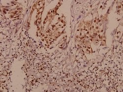 Invitrogen P-cadherin Polyclonal Antibody 100 &mu;L; Unconjugated:Antibodies,