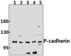 Invitrogen P-cadherin Polyclonal Antibody 100 &mu;L; Unconjugated:Antibodies,