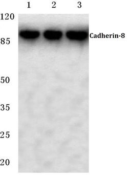 Invitrogen CDH8 Polyclonal Antibody 100 &mu;L | Buy Online | Invitrogen&trade; | Fisher Scientific