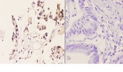 Invitrogen beta-2 Adrenergic Receptor Polyclonal Antibody 100 &mu;L; Unconjugated:Antibodies,