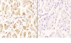 Invitrogen GCN5 Polyclonal Antibody 100 &mu;L | Buy Online | Invitrogen&trade; | Fisher Scientific