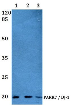Invitrogen DJ-1 Polyclonal Antibody 100 &mu;L; Unconjugated:Antibodies,