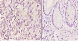 Invitrogen Ku80 Polyclonal Antibody 100 &mu;L; Unconjugated:Antibodies,