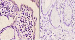 mGluR5 Polyclonal Antibody:Antibodies, Polyclonal