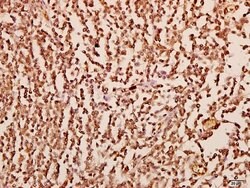 Invitrogen CXCL1 Polyclonal Antibody 100 &mu;L | Buy Online | Invitrogen&trade; | Fisher Scientific