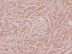 Invitrogen PPT1 Polyclonal Antibody 100 &mu;L; Unconjugated:Antibodies,