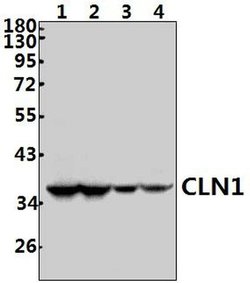 Invitrogen PPT1 Polyclonal Antibody 100 &mu;L; Unconjugated:Antibodies,