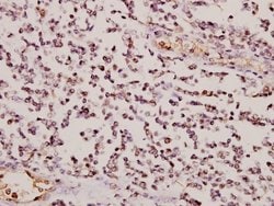Invitrogen GCLM Polyclonal Antibody 100 μL; Unconjugated:Antibodies,