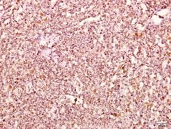 delta Catenin Polyclonal Antibody:Antibodies, Polyclonal