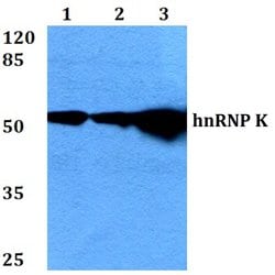 Invitrogen hnRNP K Polyclonal Antibody 100 &mu;L; Unconjugated:Antibodies,