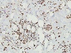 Invitrogen CD9 Polyclonal Antibody 100 &mu;L; Unconjugated:Antibodies,