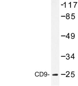 Invitrogen CD9 Polyclonal Antibody 100 &mu;L; Unconjugated:Antibodies,