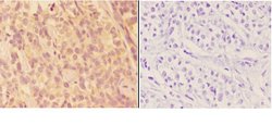 Invitrogen AKR1B1 Polyclonal Antibody 100 &mu;L; Unconjugated:Antibodies,