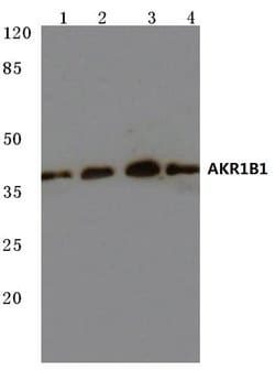 Invitrogen AKR1B1 Polyclonal Antibody 100 &mu;L; Unconjugated:Antibodies,