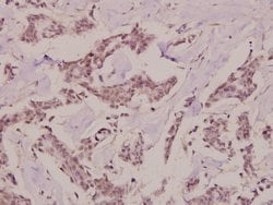 Invitrogen PKC theta Polyclonal Antibody 100 &mu;L; Unconjugated:Antibodies,