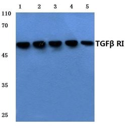 Invitrogen TGFBR1 Polyclonal Antibody 100 &mu;L; Unconjugated:Antibodies,