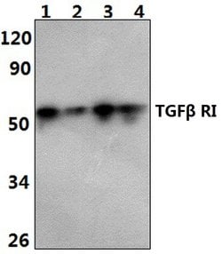 Invitrogen TGFBR1 Polyclonal Antibody 100 &mu;L; Unconjugated:Antibodies,
