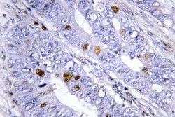 Invitrogen NR4A1 Polyclonal Antibody 100 &mu;L; Unconjugated:Antibodies,
