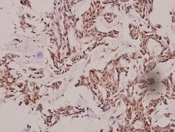 Invitrogen Cathepsin E Polyclonal Antibody 100 &mu;L; Unconjugated:Antibodies,