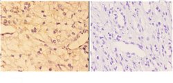 Invitrogen ACE Polyclonal Antibody 100 &mu;L; Unconjugated:Antibodies,