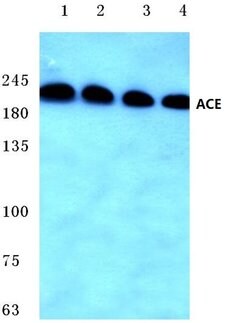 Invitrogen ACE Polyclonal Antibody 100 &mu;L; Unconjugated:Antibodies,