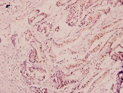 Invitrogen NF-H Polyclonal Antibody 100 &mu;L; Unconjugated:Antibodies,