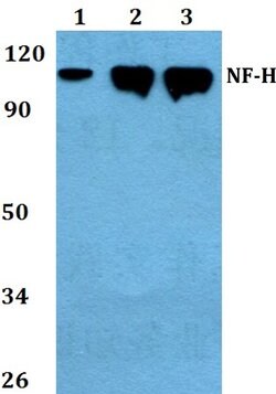 Invitrogen NF-H Polyclonal Antibody 100 &mu;L; Unconjugated:Antibodies,