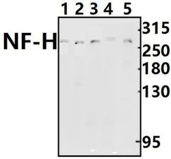 Invitrogen NF-H Polyclonal Antibody 100 &mu;L; Unconjugated:Antibodies,