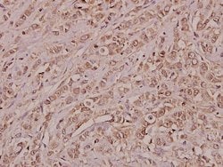 Invitrogen Annexin A3 Polyclonal Antibody 100 &mu;L; Unconjugated:Antibodies,