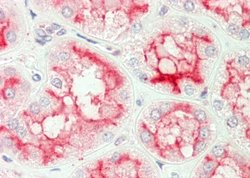Invitrogen CD13 Polyclonal Antibody 100 &mu;L; Unconjugated:Antibodies,