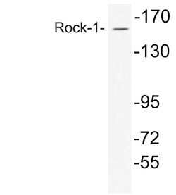 Invitrogen ROCK1 Polyclonal Antibody 100 &mu;L; Unconjugated:Antibodies,