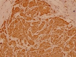 Invitrogen Cytokeratin 19 Polyclonal Antibody 100 &mu;L; Unconjugated:Antibodies,