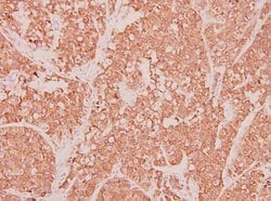 Invitrogen CCL3 Polyclonal Antibody 100 &mu;L | Buy Online | Invitrogen&trade; | Fisher Scientific