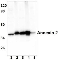 Invitrogen Annexin A2 Polyclonal Antibody 100 &mu;L; Unconjugated:Antibodies,