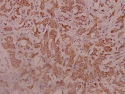 Invitrogen IL5RA Polyclonal Antibody 100 &mu;L; Unconjugated:Antibodies,