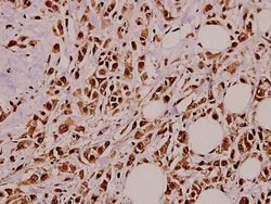 Invitrogen NGF Polyclonal Antibody 100 &mu;L; Unconjugated:Antibodies,