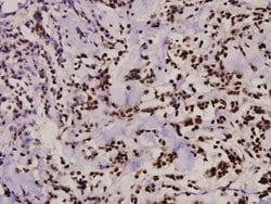 Invitrogen Zap-70 Polyclonal Antibody 100 &mu;L; Unconjugated:Antibodies,