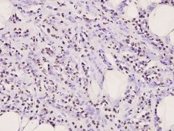 Invitrogen IkB alpha Polyclonal Antibody 100 &mu;L; Unconjugated:Antibodies,