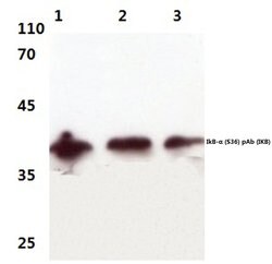 Invitrogen IkB alpha Polyclonal Antibody 100 &mu;L; Unconjugated:Antibodies,