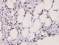 Invitrogen Stathmin 1 Polyclonal Antibody 100 &mu;L; Unconjugated:Antibodies,