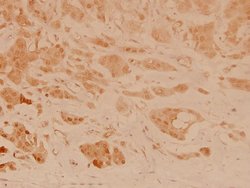 Invitrogen Stathmin 1 Polyclonal Antibody 100 &mu;L; Unconjugated:Antibodies,
