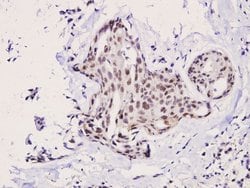 p70 S6 Kinase Polyclonal Antibody:Antibodies, Polyclonal