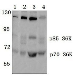 p70 S6 Kinase Polyclonal Antibody:Antibodies, Polyclonal
