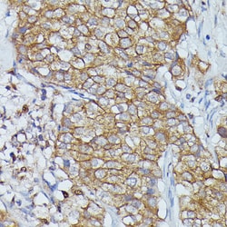 Invitrogen Cortactin Polyclonal Antibody 100 &mu;L; Unconjugated:Antibodies,
