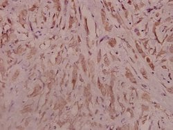 Invitrogen TrkB Polyclonal Antibody 100 &mu;L; Unconjugated:Antibodies,