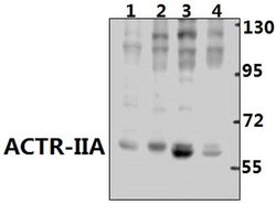Invitrogen ACVR2A Polyclonal Antibody 100 &mu;L; Unconjugated:Antibodies,