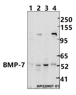 Invitrogen BMP-7 Polyclonal Antibody 100 &mu;L | Buy Online | Invitrogen&trade; | Fisher Scientific