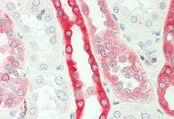 Invitrogen PKC beta Polyclonal Antibody 100 &mu;L | Buy Online | Invitrogen&trade; | Fisher Scientific