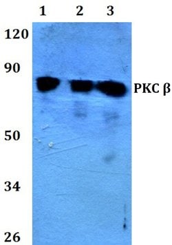 Invitrogen PKC beta Polyclonal Antibody 100 &mu;L | Buy Online | Invitrogen&trade; | Fisher Scientific