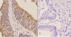 Invitrogen CD171 Polyclonal Antibody 100 &mu;L; Unconjugated:Antibodies,